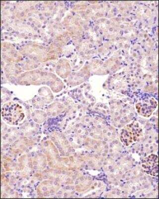 Immunohistochemistry-Paraffin: Podocin/NPHS2 Antibody [NBP3-18129]