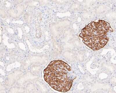 Immunohistochemistry-Paraffin: Podocin/NPHS2 Antibody (JB51-33) [NBP2-75624]