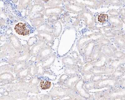 Immunohistochemistry-Paraffin: Podocin/NPHS2 Antibody (JB51-33) [NBP2-75624]