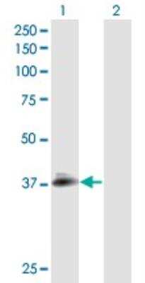 Western Blot: Podocin/NPHS2 Antibody [H00007827-B01P]