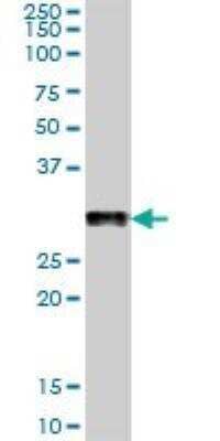 Western Blot: Podocin/NPHS2 Antibody [H00007827-B01P]