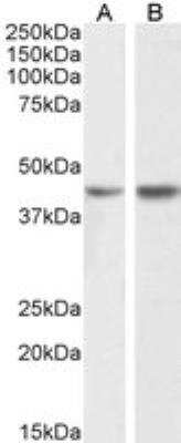 Western Blot: Podocin/NPHS2 Antibody [NBP2-26057]