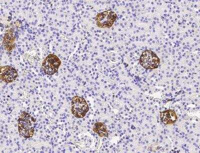 Immunohistochemistry-Paraffin: Podoplanin Antibody (066) [NBP2-89552]