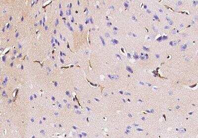 Immunohistochemistry-Paraffin: Podoplanin Antibody (066) [NBP2-89552]