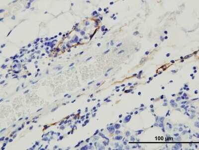 Immunohistochemistry: Podoplanin Antibody (8.1.1) - Azide and BSA Free [NBP2-80916]