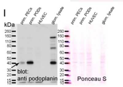 Western Blot: Podoplanin Antibody (8.1.1)BSA Free [NB600-1015]