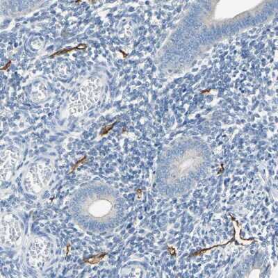 Immunohistochemistry-Paraffin: Podoplanin Antibody [NBP1-90211]