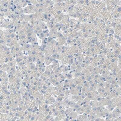 Immunohistochemistry-Paraffin: Podoplanin Antibody [NBP1-90211]