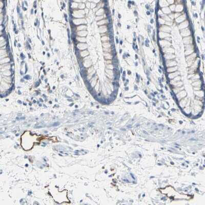 Immunohistochemistry-Paraffin: Podoplanin Antibody [NBP1-90211]