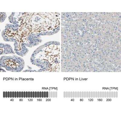 Immunohistochemistry-Paraffin: Podoplanin Antibody [NBP1-90211]