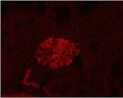 Immunocytochemistry: Podoplanin Antibody (LF3/B7/D5B27) - Azide and BSA Free [NBP2-80915]