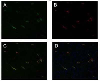 Immunohistochemistry: Podoplanin Antibody (LF3/B7/D5B27) - Azide and BSA Free [NBP2-80915]