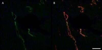 Immunohistochemistry: Podoplanin Antibody (LF3/B7/D5B27) - Azide and BSA Free [NBP2-80915]