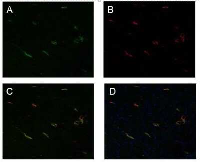 Immunohistochemistry: Podoplanin Antibody (LF3/B7/D5B27) - Azide and BSA Free [NB110-96423]