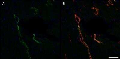 Immunohistochemistry: Podoplanin Antibody (LF3/B7/D5B27) - Azide and BSA Free [NB110-96423]
