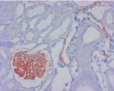 Immunohistochemistry-Paraffin: Podoplanin Antibody (LF3/B7/D5B27) - Azide and BSA Free [NB110-96423]