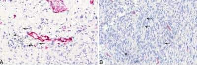 Immunohistochemistry-Paraffin: Podoplanin Antibody (LF3/B7/D5B27) - Azide and BSA Free [NB110-96423]