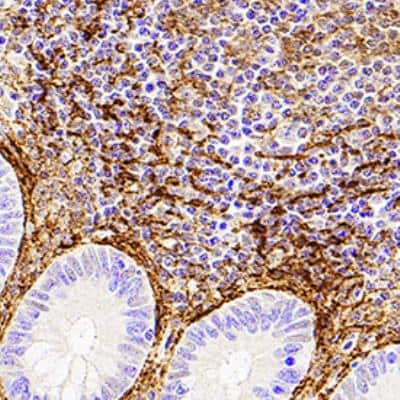 Immunohistochemistry-Paraffin: Podoplanin Antibody (NZ-1.2) - BSA Free [NBP2-03952]