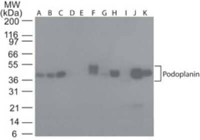 Western Blot: Podoplanin Antibody (NZ-1.2)BSA Free [NBP2-03952]