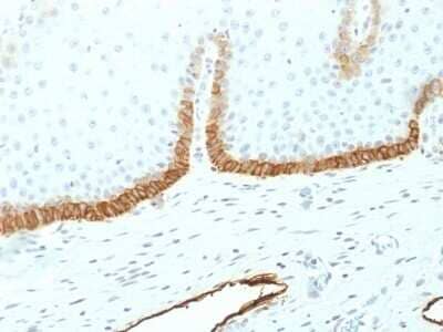 Immunohistochemistry-Paraffin: Podoplanin Antibody (PDPN/1433) - Azide and BSA Free [NBP2-54347]