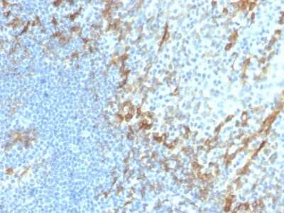Immunohistochemistry-Paraffin: Podoplanin Antibody (PDPN/4009R) [NBP3-07494]