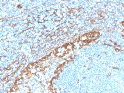 Immunohistochemistry-Paraffin: Podoplanin Antibody (PDPN/4009R) [NBP3-07494]