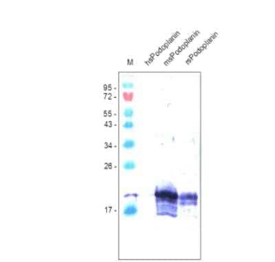 Western Blot: Podoplanin Antibody (RTD4E10)Azide and BSA Free [NBP2-36058]