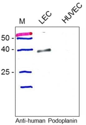 Western Blot: Podoplanin Antibody [NB600-1014]