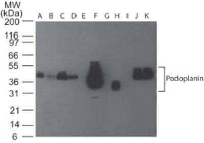 Western Blot: Podoplanin Antibody (pmab-1)Azide and BSA Free [NBP2-80917]