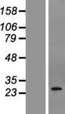 Western Blot: Podoplanin Overexpression Lysate [NBL1-14262]