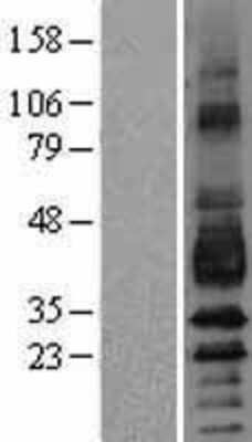 Western Blot: Podoplanin Overexpression Lysate [NBP2-11301]