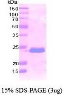 SDS-PAGE: Recombinant Human Podoplanin His Protein [NBC1-18511]