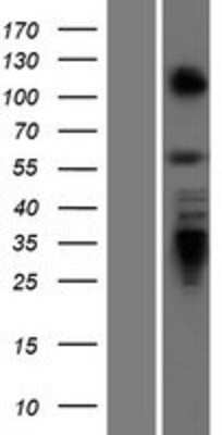 Western Blot: ZBTB7A/Pokemon Overexpression Lysate [NBP2-07114]