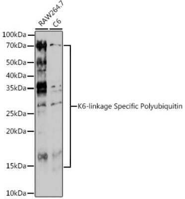 Western Blot: Poly-Ubiquitin AntibodyK6 LinkageAzide and BSA Free [NBP3-05680]