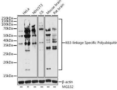 Western Blot: Poly-Ubiquitin AntibodyK63 LinkageAzide and BSA Free [NBP3-05682]