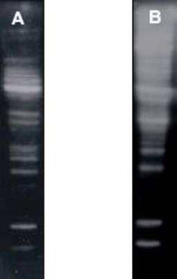 Western Blot: Poly-Ubiquitin Antibody (HWA4C4)K63 Linkage [NBP2-36523]