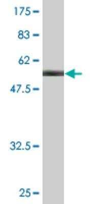 Western Blot: Polycystic kidney disease protein 1-like 2 Antibody (3G2) [H00114780-M02]