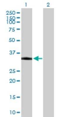 Western Blot: Polycystic kidney disease protein 1-like 2 Antibody [H00114780-B01P]