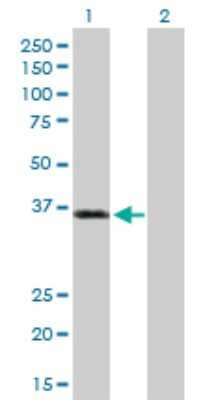 Western Blot: Polycystic kidney disease protein 1-like 2 Antibody [H00114780-D01P]