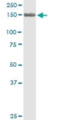 Western Blot: Polycystin 2 Antibody (4C8) [H00005311-M01]