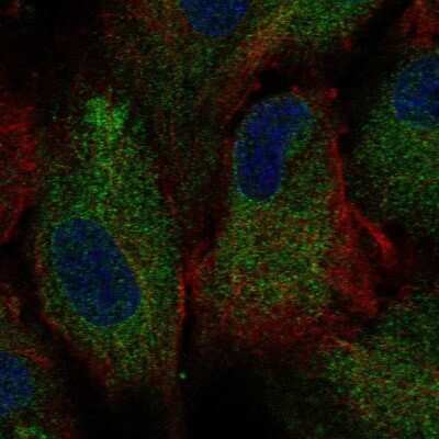 Immunocytochemistry/ Immunofluorescence: Polycystin 2 Antibody [NBP1-80944]