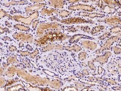 Immunohistochemistry: Polycystin 2 Antibody [NBP3-06363]