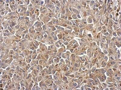 Immunohistochemistry-Paraffin: Polycystin 2 Antibody [NBP2-19889]