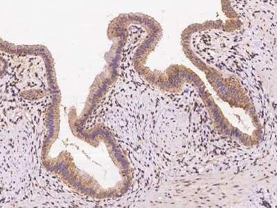 Immunohistochemistry-Paraffin: Polycystin 2 Antibody [NBP3-06363]