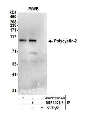 Immunoprecipitation: Polycystin 2 Antibody [NBP1-30117]