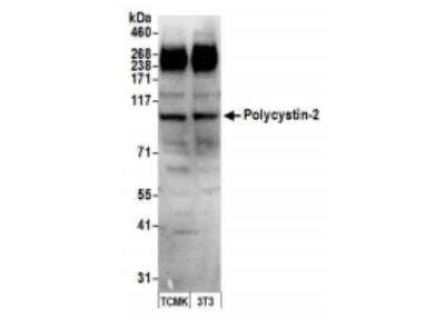 Western Blot: Polycystin 2 Antibody [NBP1-30117]