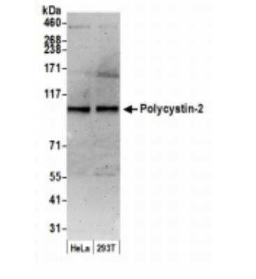 Western Blot: Polycystin 2 Antibody [NBP1-30117]