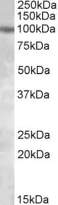 Western Blot: Polycystin 2 Antibody [NBP1-51975]