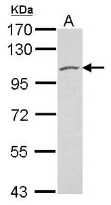 Western Blot: Polycystin 2 Antibody [NBP2-19889]