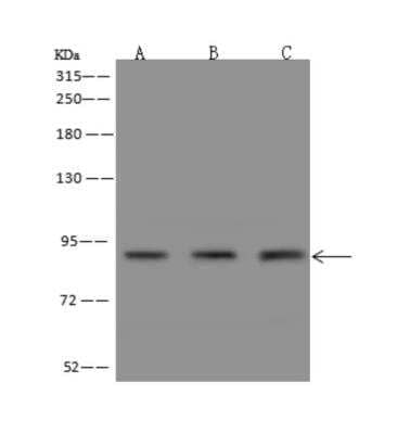 Western Blot: Polycystin 2 Antibody [NBP3-06363]